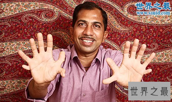 世界上最多的手指和脚趾,一共有28根