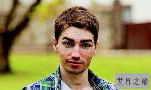 世界上最幸运的倒霉蛋,英国男子8次与死神擦肩而过