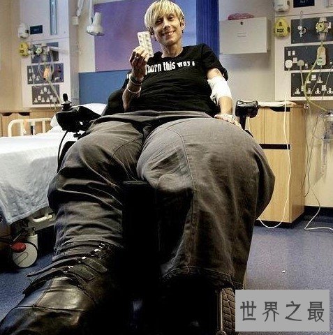 世界上最大最粗的腿,两腿达到了108公斤
