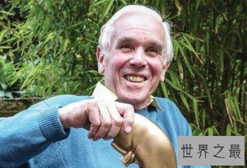 世界上肾最多的人,同时能拥有5个肾