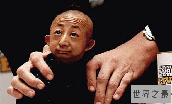 世界上体重最轻的成年人,26岁男子仅重11斤