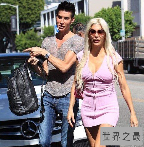 世界上整形最多的男人,200多次的外科整形手术