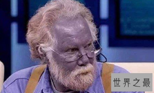 世界上最奇特的人类,原来蓝精灵的原型在这里