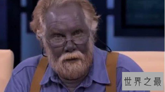 世界上最奇特的人类,原来蓝精灵的原型在这里