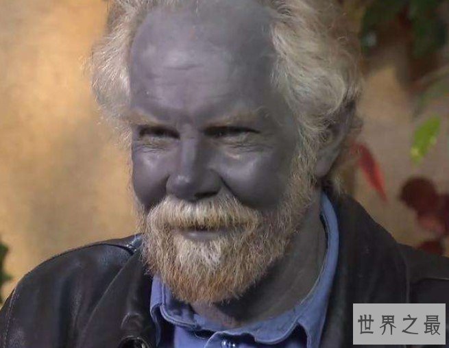 世界上最奇特的人类,原来蓝精灵的原型在这里