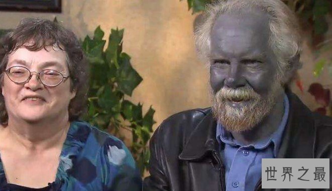 世界上最奇特的人类,原来蓝精灵的原型在这里