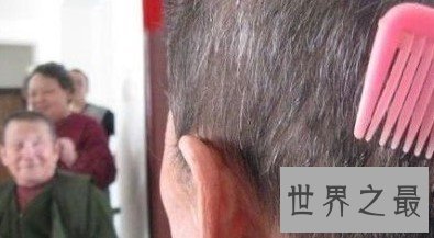 史上发育两次的老人,86岁后再次重新发育