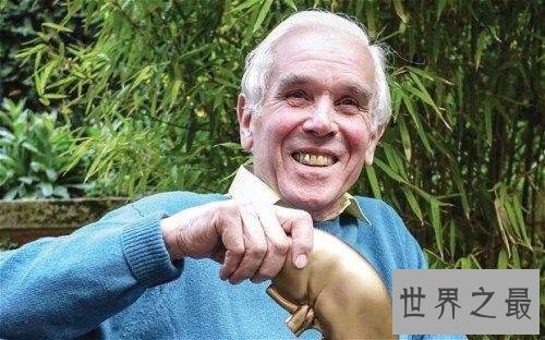 世界上肾最多的人,新西兰男子同时拥有5个正常肾脏