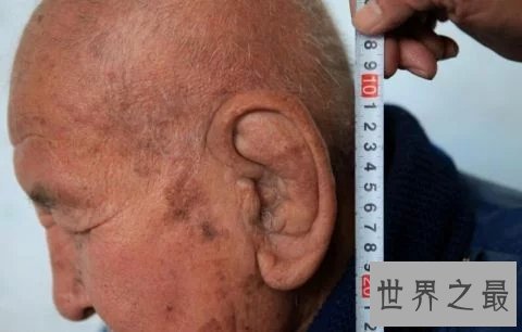 世界上最大的耳朵,长约11厘米,网友:弥勒佛转世?