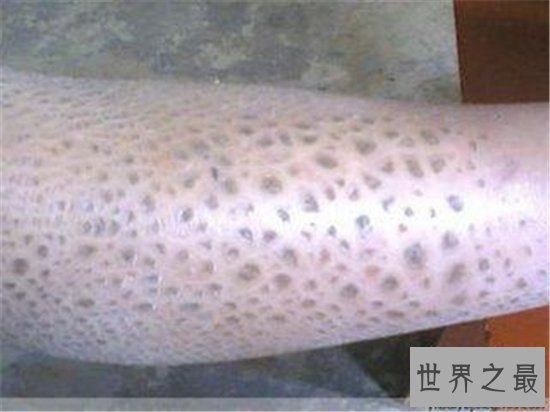 世界最奇怪的病,这种病太恐怖了简直头皮发麻!