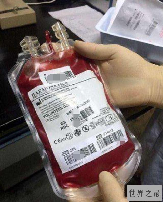 世界最罕见的血型,仅中国发现一例,世上再无出现