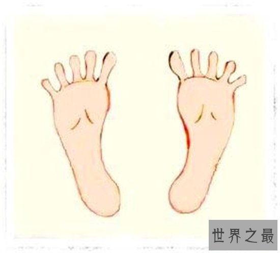 世界上最多手指和脚趾的人,脚趾手指加起来二十多跟!