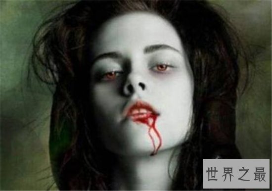 世界上最可怕的怪病,一起来看一下啊吸血鬼症多可怕!