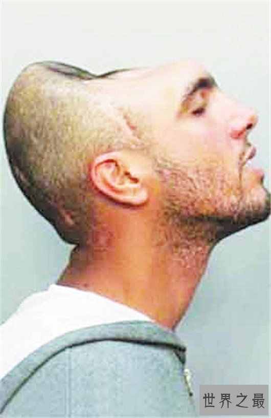 世界最奇葩脑袋,难道是来自外星的人