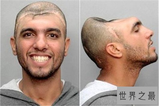 世界最奇葩脑袋,难道是来自外星的人