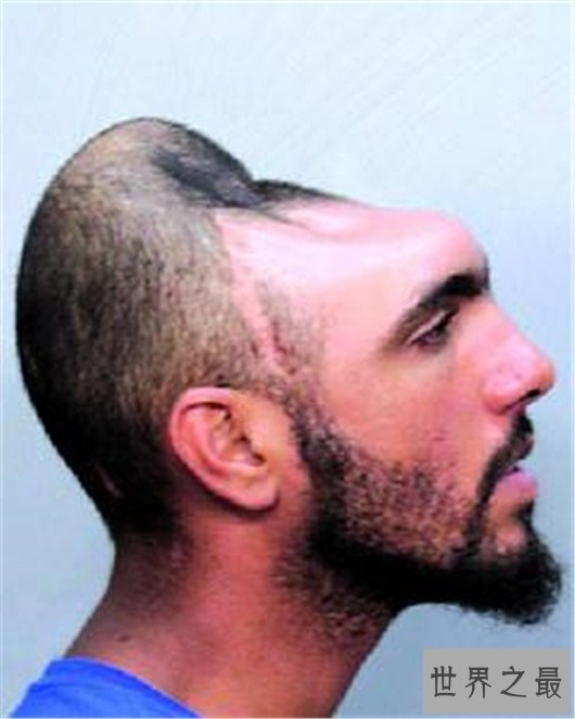 世界最奇葩脑袋,难道是来自外星的人