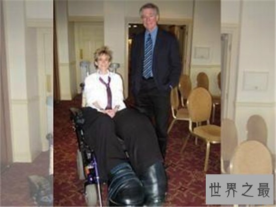 世界最粗的腿,正常人难以想象!