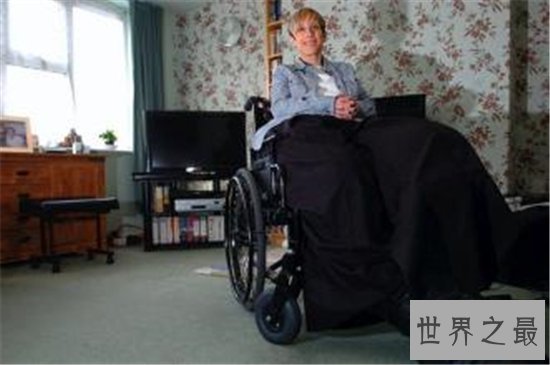 世界最粗的腿,正常人难以想象!