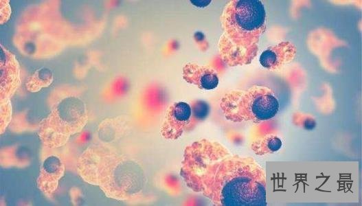 癌症之最,男性获得癌症的几率最大!