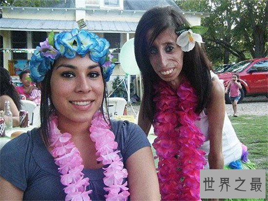 世界上最恶心的人是谁？曾出演电影《世界最丑人》