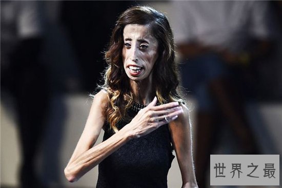 世界上最恶心的人是谁？曾出演电影《世界最丑人》