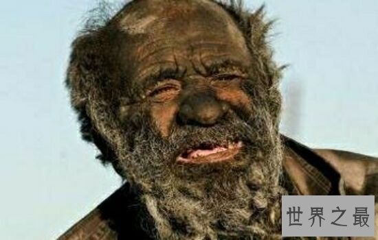 人类最长时间不洗澡记录，想想都觉得难受。