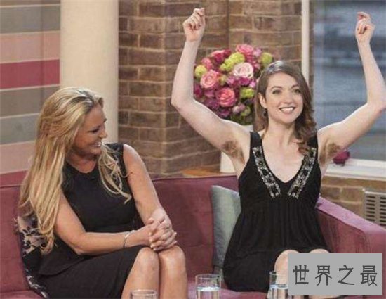 艾米丽·苏珊满身毛发的原因,这是不常见的返祖现象