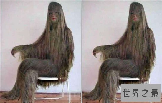 艾米丽·苏珊满身毛发的原因,这是不常见的返祖现象