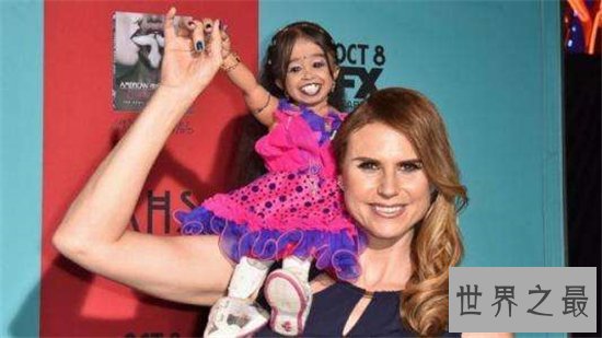 世界上毛最多的人，中国第一毛孩被认为孙悟空转世