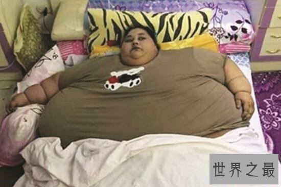 世界最胖的女人排行榜，罗莎莉达到了可怕的540kg！