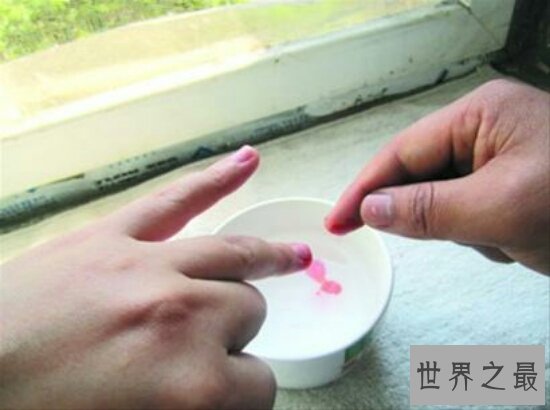 滴血认亲,是一种不科学的检验方式,DNA检验才是王道