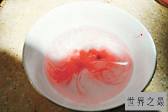 滴血认亲,是一种不科学的检验方式,DNA检验才是王道