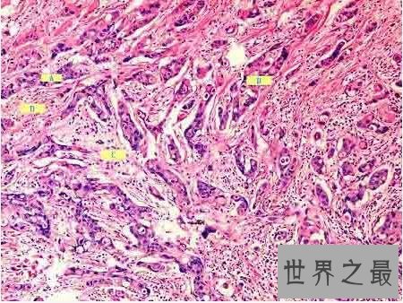 人体最大的器官是肝脏 最新发现的最大器官能分散癌症
