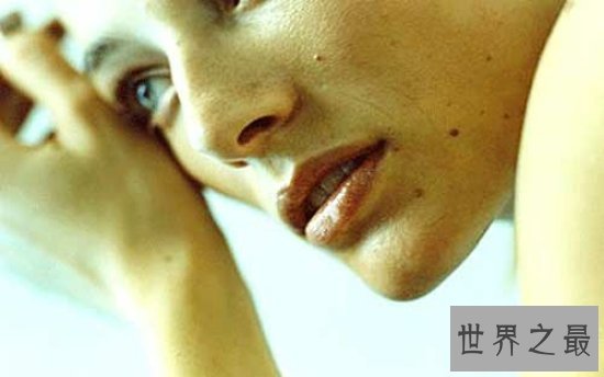 痣是怎么形成的?大部分都是因为人的基因原因