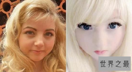 白化病萝莉,虽然不幸患病,却拥有着超人的乐观心态