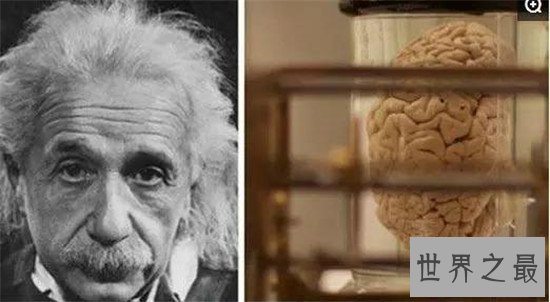 爱因斯坦的大脑真的与众不同？ 是因此他才有如此成就