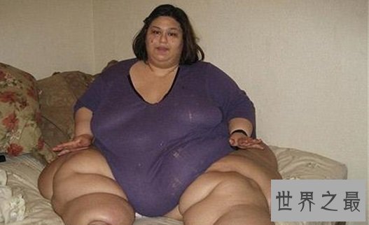 世界上最胖的人排行榜，前五名的死因都与肥胖有关