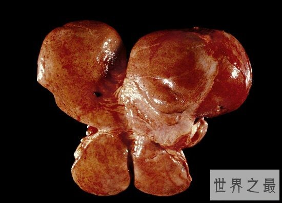 肝在什么位置？肝不好该如何调理？进来告诉你答案