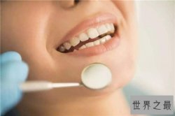 人有多少颗牙齿 8种牙齿不拔出影响身体疾病
