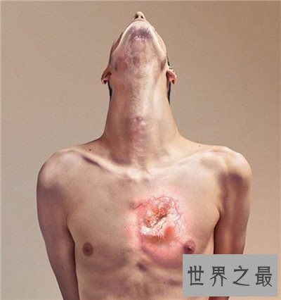 核辐射对人体的危害 怎样预防和治愈核辐射