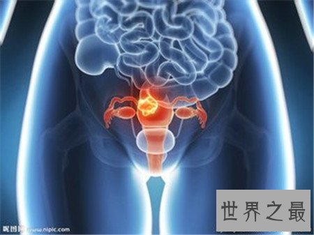 作为女人 你不得不了解的女性生殖器图