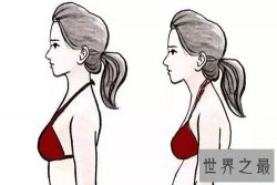 含胸是什么意思 怎么改善不良含胸驼背习惯