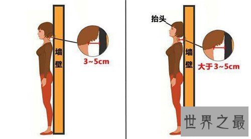 含胸是什么意思 怎么改善不良含胸驼背习惯