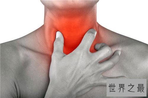 咽炎的治疗方法有哪些 不及时治疗很有可能危及生命