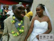 最丑的男人脸部长瘤五官变样 乌干达最丑男人靠脸吃饭