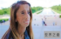 世界上最丑的女人，但是她却拥有美丽的心灵