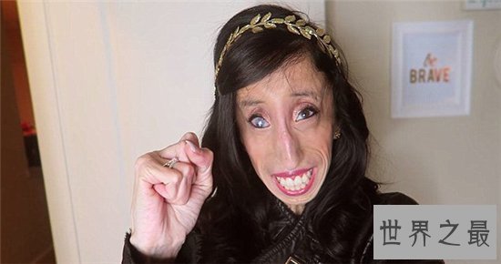 世界上最丑的女人,但是她却拥有美丽的心灵