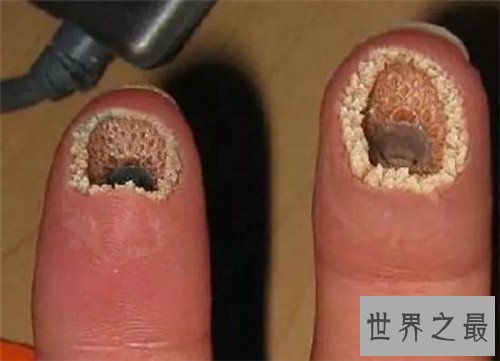 最恶心的图片有哪些 世界上最恶心的男人与女人