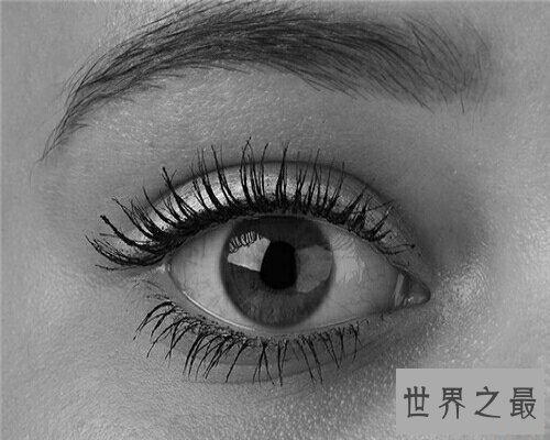 麦粒肿就是我们俗称的针眼，看一下麦粒肿图片来了解一下