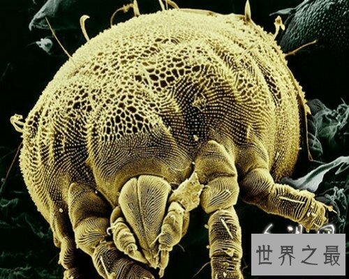  让我们来通过螨虫图片来认识螨虫吧